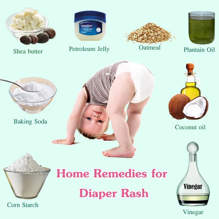 डायपर रैशेज का घरेलु उपचार - home remedy for diaper rash
